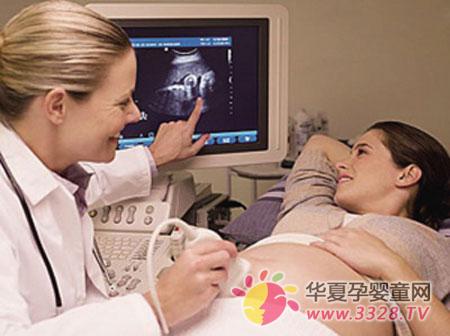 支招--教孕妈学看胎心监护图 支招--教孕妈学看胎心监护图