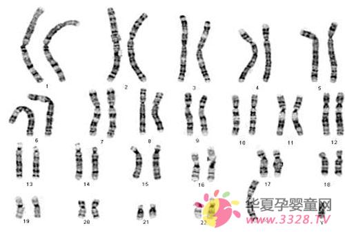 染色体带来的遗传病 染色体带来的遗传病