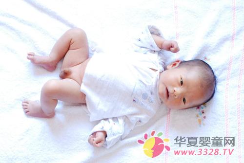 婴儿脐疝的症状及治疗方法 婴儿脐疝的症状及治疗方法