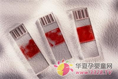 孕妇 检查血型