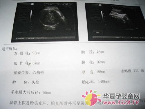 B������ô��