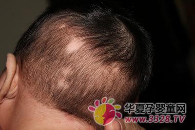 ������ͺ��ô��