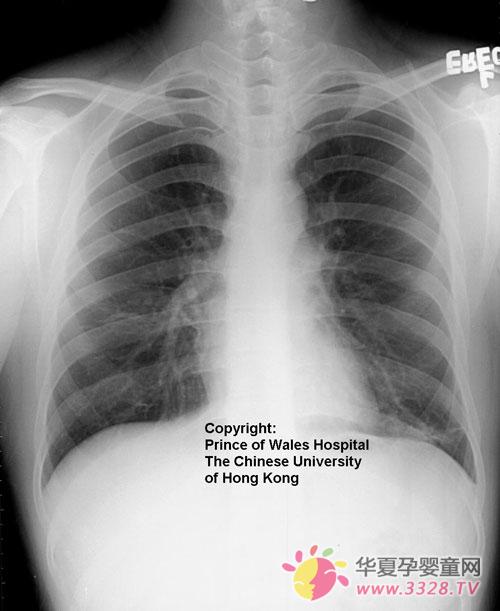 �ǵ��ͷ��׸��������