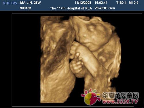 ̥����ʲô�о�