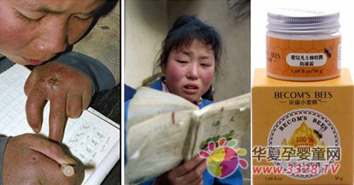 ����С�۷䱴�������پ����װ���