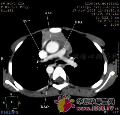 �����ζ�������խ��Ҫ������