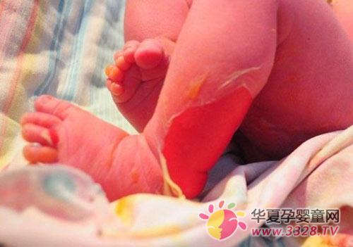 Ӥ���������츾��Ժϴ�� ȫ��������43%