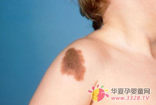 ��Щ̥�ǶԺ�����Σ��